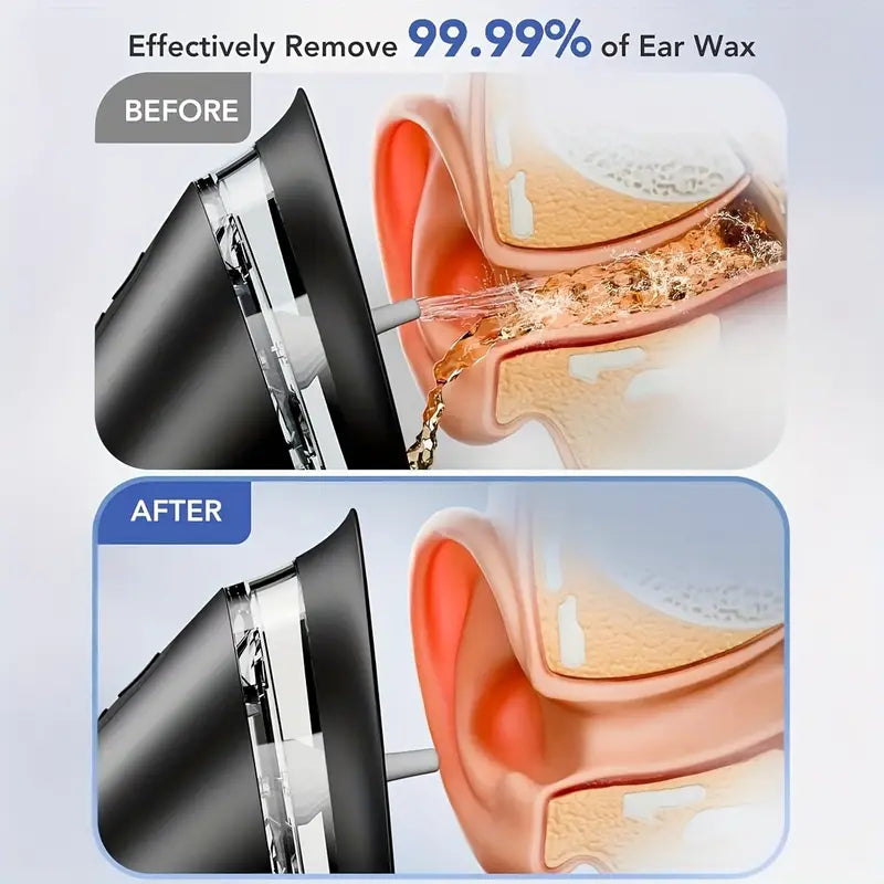 3-Speed Electric Ear Wax Removal System Pro | Hydraulic Ear Cleaner Kit with Water Temp Sensor & Visual Waste Tank - Rechargeable USB, Dry/Dirty Storage, Nozzle Belt, Medical-Grade Home Care
