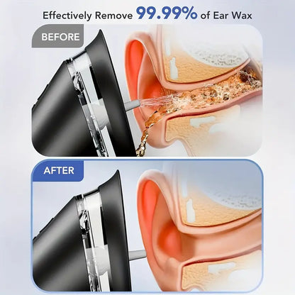 3-Speed Electric Ear Wax Removal System Pro | Hydraulic Ear Cleaner Kit with Water Temp Sensor & Visual Waste Tank - Rechargeable USB, Dry/Dirty Storage, Nozzle Belt, Medical-Grade Home Care